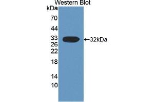 Detection of Recombinant CAPN3, Human using Polyclonal Antibody to Calpain 3 (CAPN3) (Calpain 3 antibody  (AA 602-821))