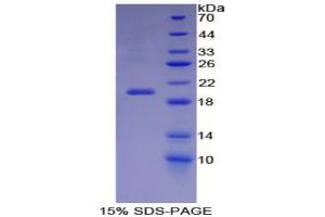 SDS-PAGE analysis of Mouse Carbonic Anhydrase VI Protein.