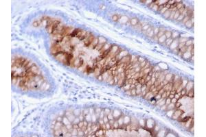 Immunohistochemistry (IHC) image for anti-Mucin 4, Cell Surface Associated (MUC4) (AA 1730-1864) antibody (ABIN6940126)