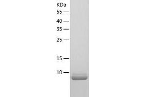Western Blotting (WB) image for Chemokine (C-C Motif) Ligand 3 (CCL3) (AA 24-92) protein (His tag) (ABIN7122300) (CCL3 Protein (AA 24-92) (His tag))