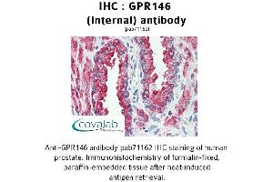 Image no. 2 for anti-G Protein-Coupled Receptor 146 (GPR146) (Internal Region) antibody (ABIN1734950)
