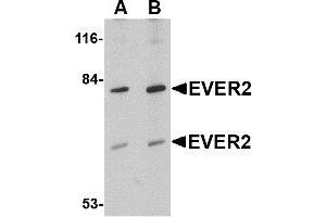 Western Blotting (WB) image for anti-Transmembrane Channel-Like 8 (TMC8) (Middle Region) antibody (ABIN1030928) (TMC8 antibody  (Middle Region))