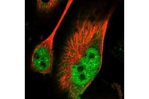 Immunofluorescent staining of U-251 MG with PAK7 polyclonal antibody  (Green) shows positivity in nucleus but excluded from the nucleoli. (PAK7 antibody)