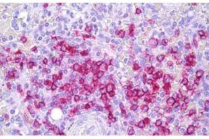 Anti-CD45RB antibody IHC staining of human spleen, lymphocytes. (CD45RB antibody)