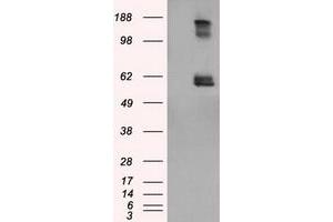 Image no. 1 for anti-Lipase, Endothelial (LIPG) antibody (ABIN1499168) (LIPG antibody)