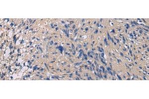 Immunohistochemistry of paraffin-embedded Human brain tissue using CHST3 Polyclonal Antibody at dilution of 1:35(x200) (CHST3 antibody)