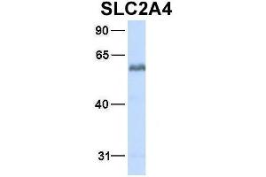 Host:  Rabbit  Target Name:  SLC2A4  Sample Type:  Human Fetal Heart  Antibody Dilution:  1. (GLUT4 antibody  (N-Term))
