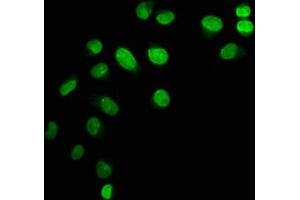 Immunofluorescence staining of Hela cells with ABIN7139603 at 1:12. (HIST1H1C antibody  (meLys45))