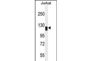 ADCY2 antibody  (AA 451-481)