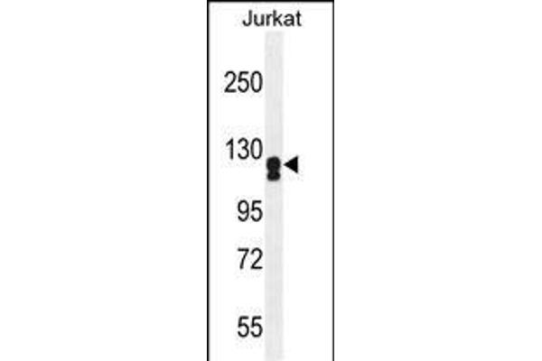 ADCY2 antibody  (AA 451-481)