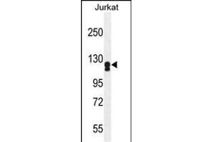 ADCY2 Antibody (Center) (ABIN655269 and ABIN2844861) western blot analysis in Jurkat cell line lysates (35 μg/lane).