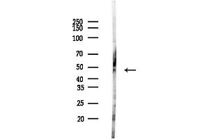 anti-ECSIT (ECSIT) (Internal Region) antibody