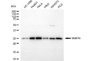 anti-Small Nuclear Ribonucleoprotein Polypeptides B and B1 (SNRPB) antibody