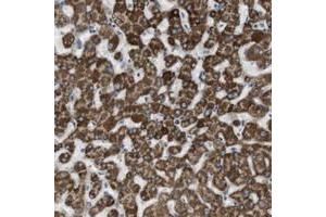 Immunohistochemical staining of human liver with MARC2 polyclonal antibody  shows strong cytoplasmic positivity in hepatocytes.