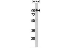 Western blot analysis of HTATSF1 Antibody (N-term) in Jurkat cell line lysates (35ug/lane). (HTATSF1 antibody  (N-Term))