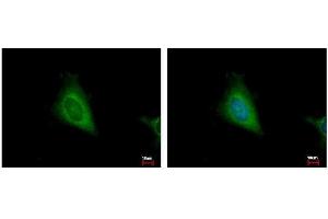 ICC/IF Image HSD17B4 antibody detects HSD17B4 protein at cytoplasm by immunofluorescent analysis. (HSD17B4 antibody  (N-Term))