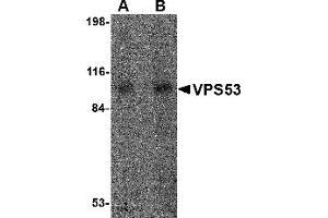 Western Blotting (WB) image for anti-Vacuolar Protein Sorting 53 Homolog (VPS53) (Middle Region) antibody (ABIN1031162) (VPS53 antibody  (Middle Region))