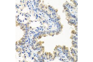 Immunohistochemistry of paraffin-embedded mouse lung using LRG1 antibody at dilution of 1:100 (40x lens). (LRG1 antibody)