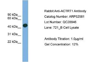 WB Suggested Anti-ACTRT1  Antibody Titration: 0. (ACTRT1 antibody  (Middle Region))