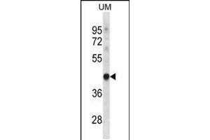 Western blot analysis in uterus tumor cell line lysates (35ug/lane). (TRUB1 antibody  (AA 152-180))