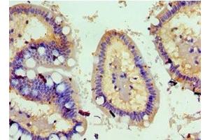 Immunohistochemistry of paraffin-embedded human small intestine tissue using ABIN7173812 at dilution of 1:100 (TNFSF18 antibody  (AA 72-199))