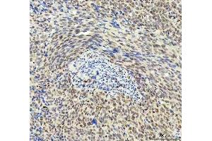 IHC analysis of DDX1 using anti-DDX1 antibody (ABIN7602052). (DDX1 antibody  (AA 562-740))