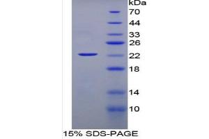 SDS-PAGE of Protein Standard from the Kit (Highly purified E. (IFNA ELISA Kit)