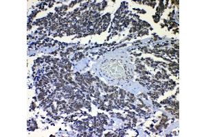 IHC analysis of nmt55/p54nrb using anti-nmt55/p54nrb antibody (ABIN3044530). (NONO antibody  (N-Term))