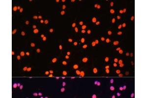 Immunofluorescence analysis of C6 cells using ZNF581 Polyclonal Antibody at dilution of 1:100 (40x lens). (ZNF581 antibody)