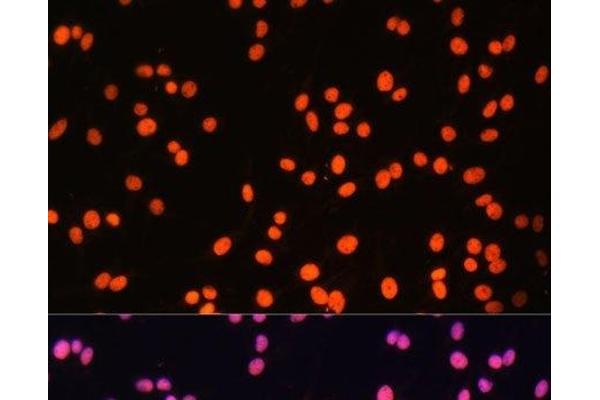 ZNF581 antibody