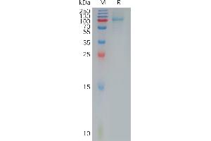Interleukin 12 Receptor beta 1 (IL12RB1) (AA 24-540) protein (His tag)