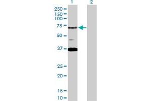 Western Blot analysis of RAD17 expression in transfected 293T cell line by RAD17 MaxPab polyclonal antibody. (RAD17 antibody  (AA 1-584))