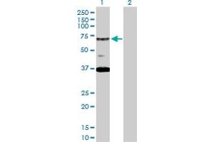 Western Blot analysis of RAD17 expression in transfected 293T cell line by RAD17 MaxPab polyclonal antibody. (RAD17 antibody  (AA 1-584))
