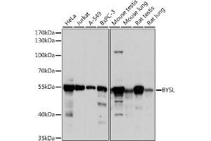 Western blot analysis of extracts of various cell lines, using BYSL antibody (ABIN6129546, ABIN6137672, ABIN6137674 and ABIN6215553) at 1:1000 dilution. (Bystin-Like antibody  (AA 120-280))