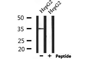 Western blot analysis of extracts from HepG2, using MSHR Antibody. (MC1 Receptor antibody  (C-Term))