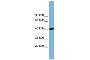 PINX1 antibody used at 1 ug/ml to detect target protein. (PINX1 antibody  (N-Term))
