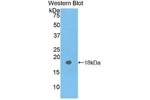 Western Blotting (WB) image for anti-Carcinoembryonic Antigen Gene Family (CEA) antibody (Biotin) (ABIN1172455) (CEA antibody  (Biotin))