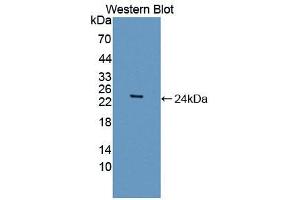 Figure. (CSRP1 antibody  (AA 1-193))