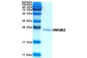 SDS-PAGE with Coomassie Blue Staining (HMGB2 Protein)