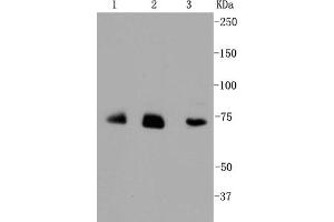 Lane 1: JAR lysates, Lane 2: HUVEC lysates, Lane 3: Hela lysates probed with Alas1 (1G11) Monoclonal Antibody  at 1:1000. (ALAS1 antibody)