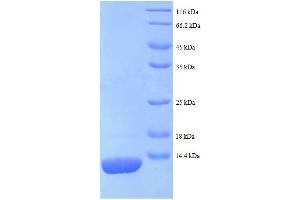 SDS-PAGE (SDS) image for Ribosomal Protein L27 (RPL27) (AA 2-85) protein (His tag) (ABIN5712642)