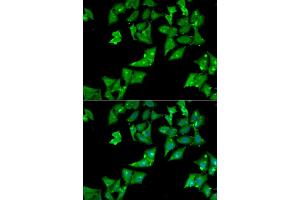 Immunofluorescence analysis of HeLa cells using AGA antibody (ABIN5973763). (AGA antibody)