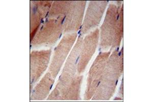 Immunohistochemistry analysis in Formalin Fixed, Paraffin Embedded Human skeletal muscle using RPL5 Antibody (N-term) followed by peroxidase conjugation of the secondary antibody and DAB staining. (RPL5 antibody  (N-Term))