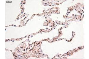 Image no. 4 for anti-Myc Proto-Oncogene protein (MYC) antibody (ABIN1497013) (c-MYC antibody)