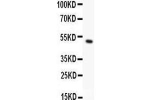 Anti- CD146 antibody, Western blotting All lanes: Anti CD146  at 0.