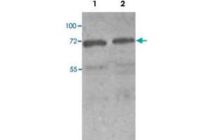 Western blot analysis of HeLa (Lane 1) and MCF-7 (Lane 2) cell lysate with PAK4 polyclonal antibody  at 1 : 250 dilution. (PAK4 antibody  (N-Term))
