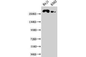 Western Blot Positive WB detected in: Raji whole cell lysate, K562 whole cell lysate All lanes: ATR antibody at 1:2000 Secondary Goat polyclonal to rabbit IgG at 1/50000 dilution Predicted band size: 302, 295, 298 kDa Observed band size: 302 kDa