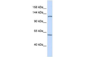 PHF12 antibody used at 0. (PHF12 antibody  (C-Term))