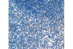 IHC-P analysis of Mouse Tissue, with DAB staining. (Cathelicidin antibody  (AA 31-173))