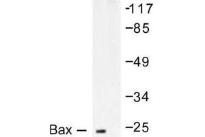 Image no. 2 for anti-BCL2-Associated X Protein (BAX) antibody (ABIN265325) (BAX antibody)